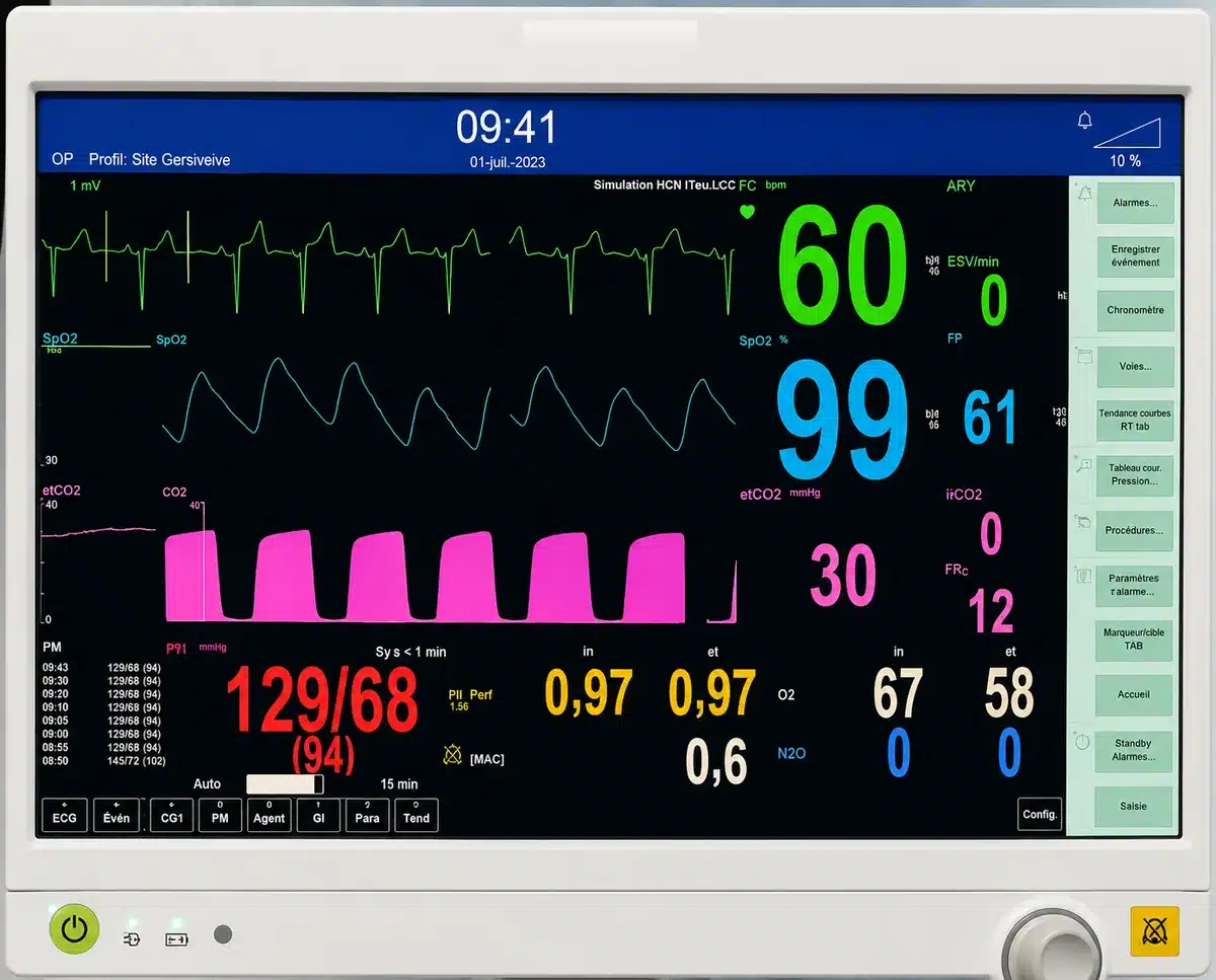 formation infirmier en SSPI : monitorage et surveillance du patient en salle de réveil