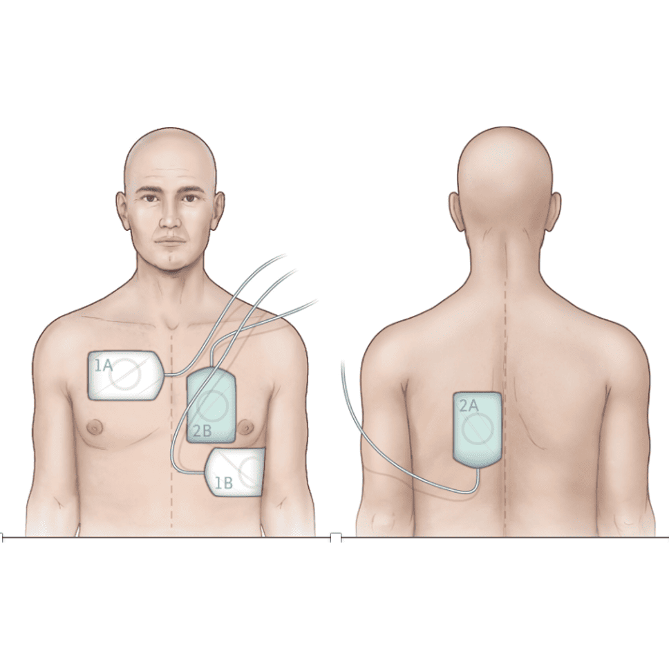 prise en charge de l’arrêt cardiaque